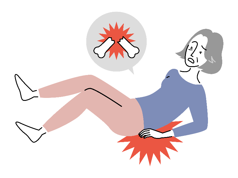 Zeichnung von einer hingefallenen Frau mit Schwerzen und Grafik Knochenbruch.